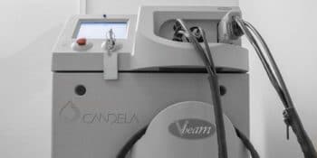 Vbeam Syneron Candela