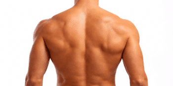 Depilación láser en la espalda masculina: cuántas sesiones necesitas y qué resultados puedes esperar